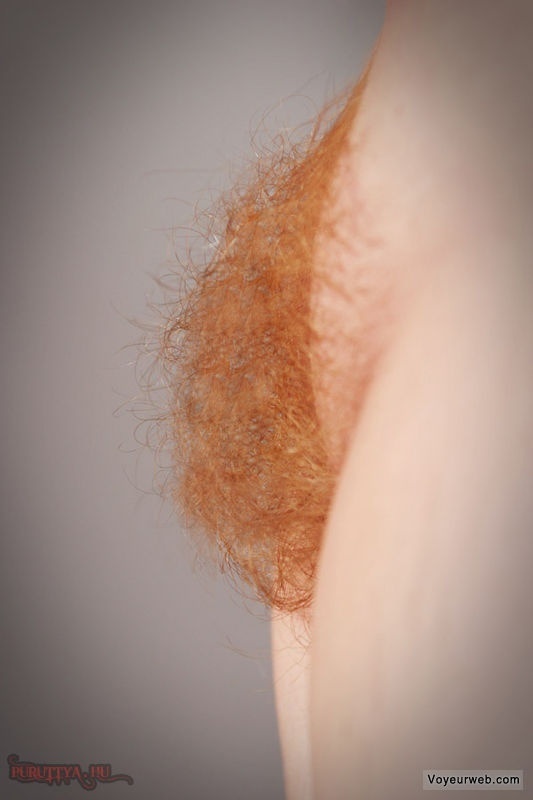 ...; Hairy Red Head 